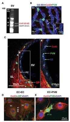 Suppression of Connexin 43 Leads to Strial Vascular Hyper-Permeability, Decrease in Endocochlear Potential, and Mild Hearing Loss